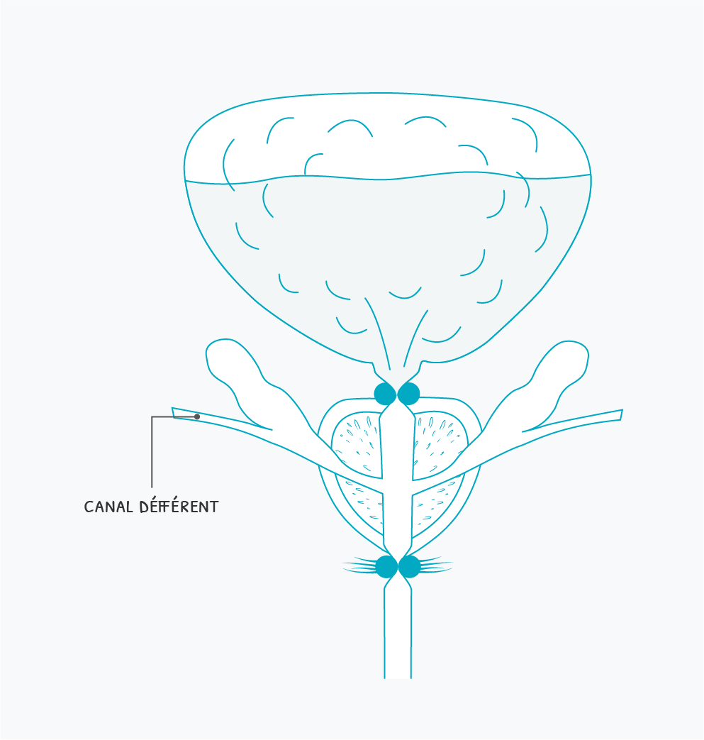 schema-incontinence-sphincter-vessie-pleine